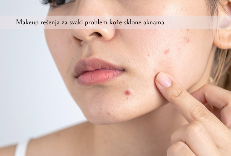 makeup za prekrivanje akni