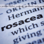 rozacea uzroci i lecenje