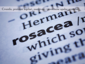 rozacea uzroci i lecenje