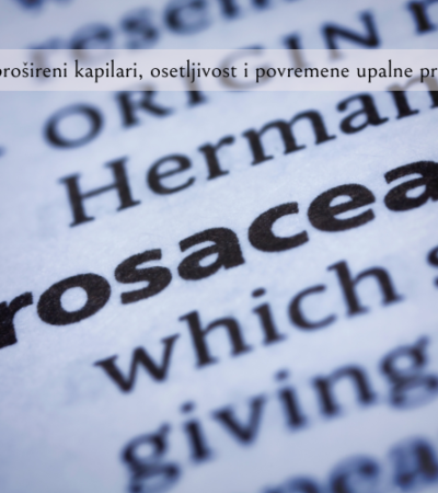 rozacea uzroci i lecenje