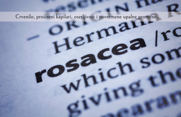 rozacea uzroci i lecenje